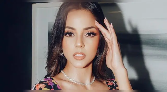 Luciana Fuster revela que sufrió accidente casero tras quemarse con agua caliente.