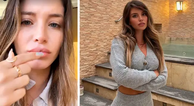 Flavia Laos preocupada por golpes tras accidente.