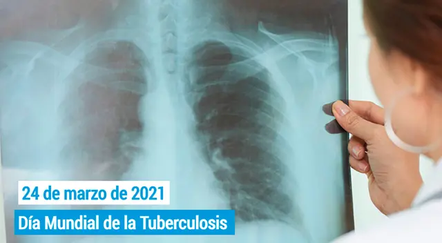 La tuberculosis es causada por una bacteria llamada Mycobacterium tuberculosis atacan a los pulmones, pero también puede afectar a otras partes del cuerpo.
