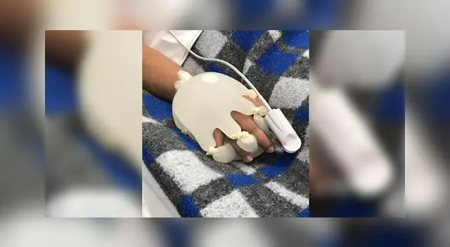 Lidiane Melo es una enfermera de 37 años que trabaja en Río de Janeiro. Lidiane Melo es una enfermera de 37 años que trabaja en Río de Janeiro.