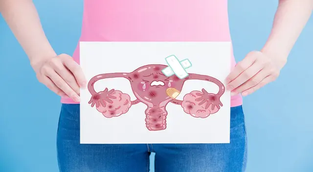El cáncer de cuello uterino provoca la muerte de 3 mil mujeres peruanas al año. El cáncer de cuello uterino provoca la muerte de 3 mil mujeres peruanas al año.