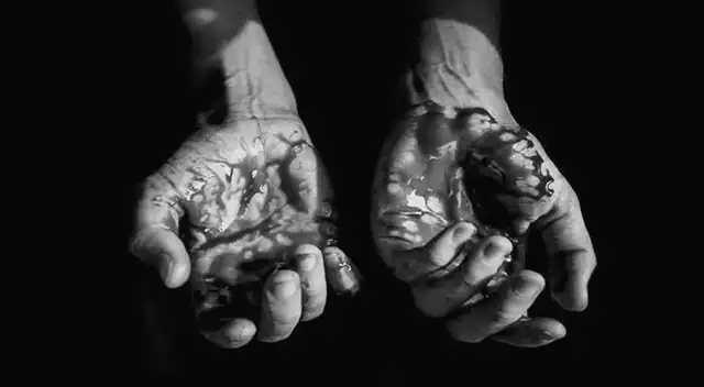 ¿Qué significa soñar con sangre de otra persona? Conoce aquí la interpretación