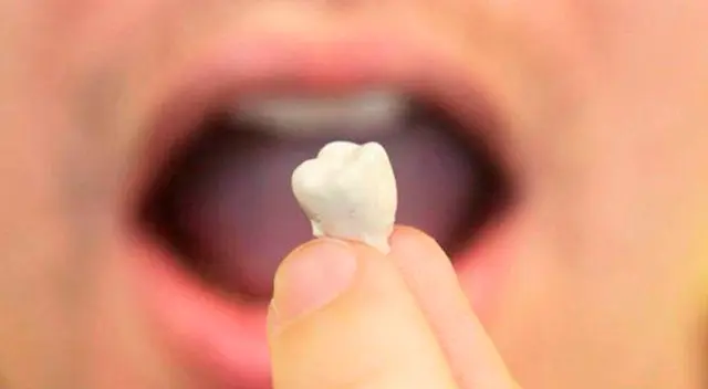 Soñar con la caída de los dientes superiores: normalmente está asociado al dolor de una pérdida de algún ser querido.