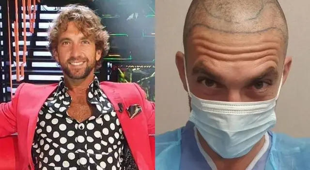 El torero Antonio Pavón sorprendió a sus seguidores al mostrar el tratamiento que recibió en España para evitar la calvicie. El torero Antonio Pavón sorprendió a sus seguidores al mostrar el tratamiento que recibió en España para evitar la calvicie.