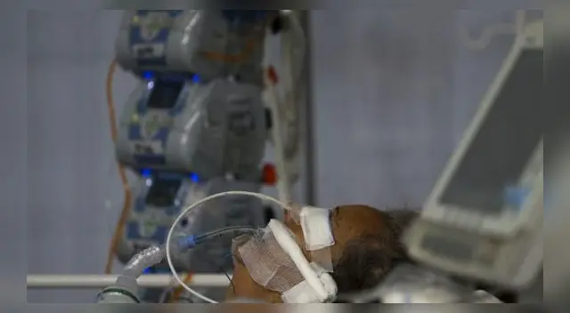 Un paciente de coronavirus COVID-19 intubado es atendido en una Unidad de Cuidados Intensivos de un hospital de Brasil. Un paciente de coronavirus COVID-19 intubado es atendido en una Unidad de Cuidados Intensivos de un hospital de Brasil.