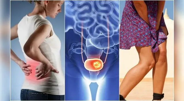 La vejiga está ubicada en la parte inferior del abdomen y su función es vital ya que almacena la orina procedente de los riñones para posteriormente expulsarla.