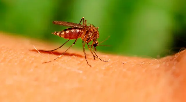 Aprende a cuidar tu piel para evitar complicaciones.