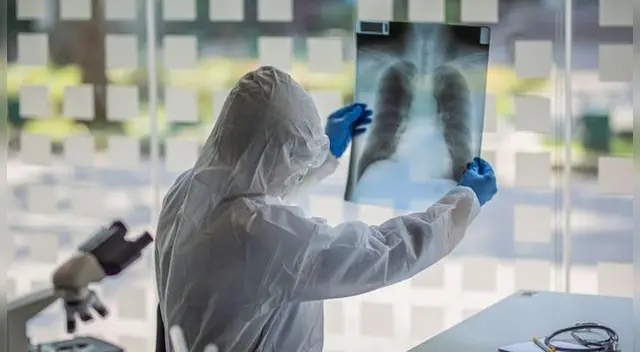 Hipoxia, síntoma silencioso de la COVID-19.