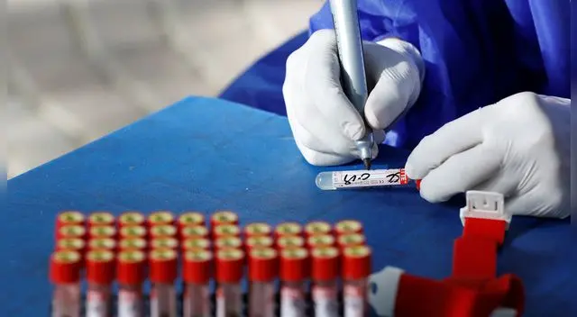 EE. UU.: crean prueba que determina si la persona con COVID-19 desarrollara síntomas graves. EE. UU.: crean prueba que determina si la persona con COVID-19 desarrollara síntomas graves.