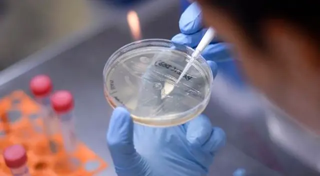 El paciente corresponde a un hombre de 40 años y comenzó con síntomas a principios de abril.