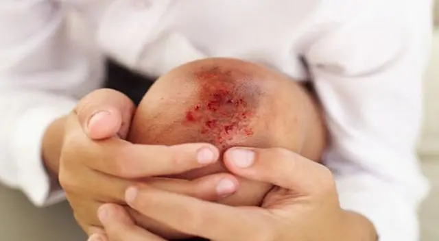 Si tus heridas por más pequeñas que sean sangran demasiado, acude al médico. Si tus heridas por más pequeñas que sean sangran demasiado, acude al médico.