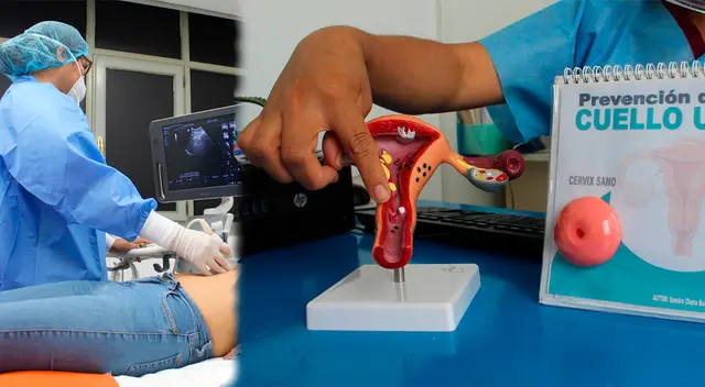 EsSalud alerta a mujeres sobre aumento de cáncer de mama y cuello uterino.