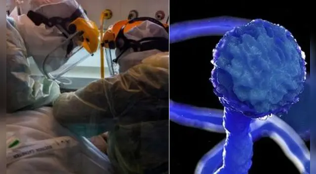 Alarma en Uruguay: detectan caso del “hongo negro”, rara infección que ataca a pacientes de COVID-19 .