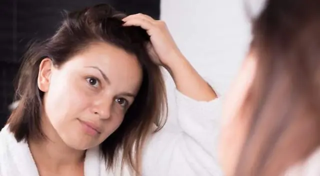 Puede lucir más grasoso y esponjoso durante la dulce espera. Puede lucir más grasoso y esponjoso durante la dulce espera.