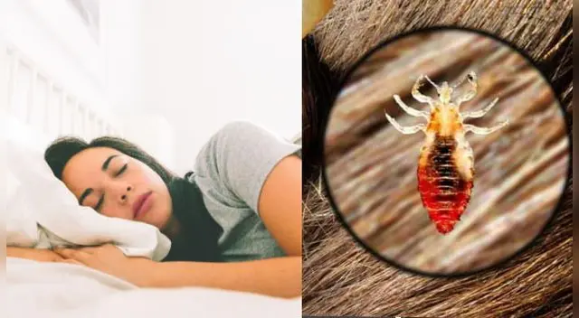 Interpretación de los sueños: ¿Qué significa soñar con piojos y matarlos?