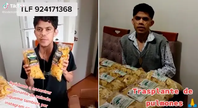 Eder Campos, de 25 años, sufre de fibrosis pulmonar.