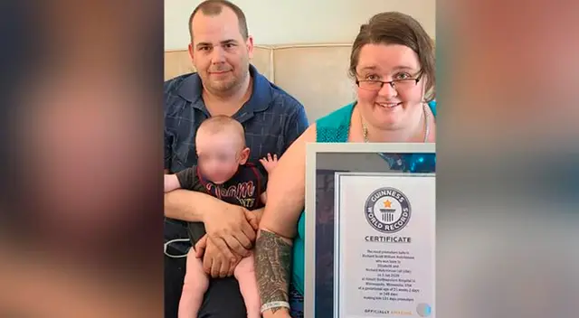 “No podía creer que este fuera el mismo niño que una vez estuvo tan enfermo, que temí que no sobreviviera”, dijo el padre del bebé.