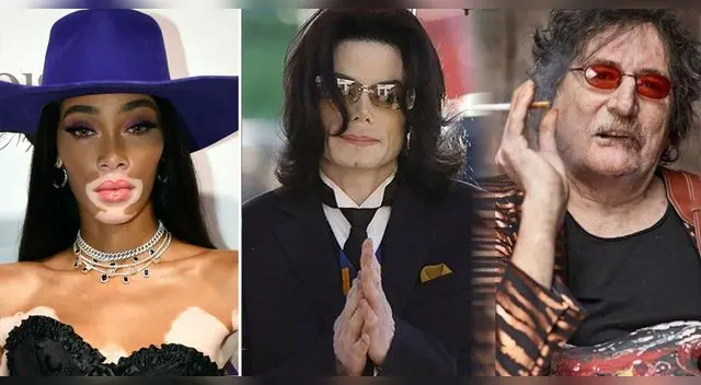Michael Jackson y algunos famosos que aprendieron a vivir con Vitíligo