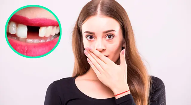 Significado de soñar que se caen los dientes de arriba Significado de soñar que se caen los dientes de arriba