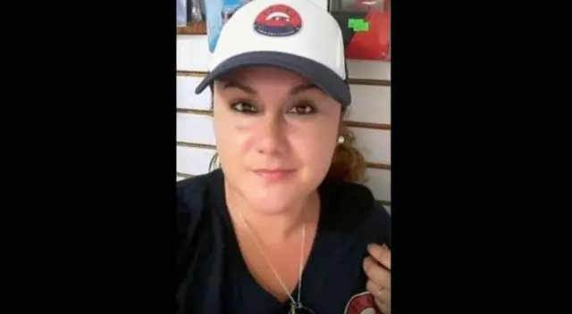 El dolor no se fue y la mujer de 37 años visitó a muchos especialistas hasta que un maxilofacial detectó que el dolor venía del hueso.