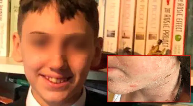 Barney Rae señala que no soporta el dolor de su enfermedad. Barney Rae señala que no soporta el dolor de su enfermedad.