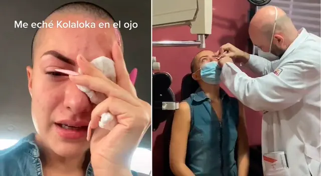 La joven contó que le tuvieron que cortar las pestañas.