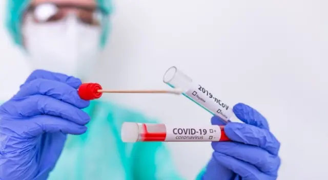 El especialista recomienda seguir protegiéndonos con el uso de mascarillas y lavado de manos.