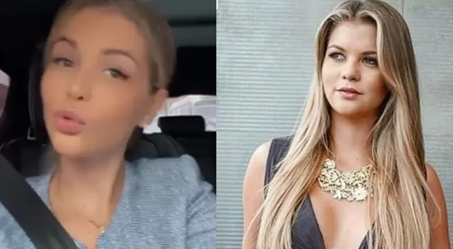 Brunella Horna se habría realizado un nuevo aumento de labios