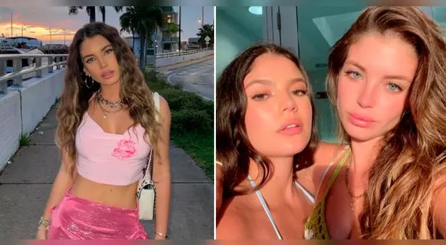 La actriz se habría realizado nueva intervención estética en el rostro. La actriz se habría realizado nueva intervención estética en el rostro.