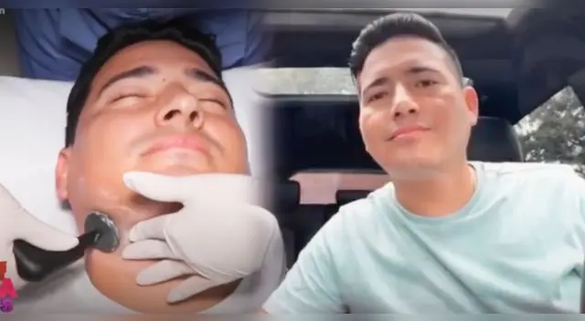 Pedro Loli se sometió a un procedimiento no invasivo.