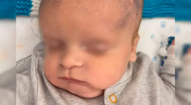 El pequeño Carson Murgatroyd tiene un absceso y un quiste en el cerebro. El pequeño Carson Murgatroyd tiene un absceso y un quiste en el cerebro.