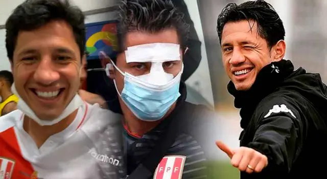 Gianluca Lapadula habló acerca de su tabique que se desvió en la Copa América 2021. Gianluca Lapadula habló acerca de su tabique que se desvió en la Copa América 2021.