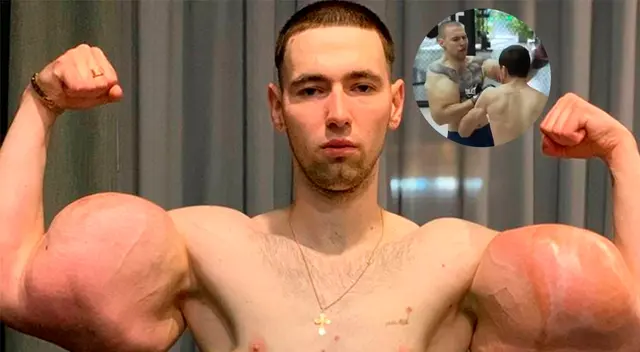 “Mi bíceps se rompió durante la pelea, esto es el final”, dijo tras la lesión. “Mi bíceps se rompió durante la pelea, esto es el final”, dijo tras la lesión.