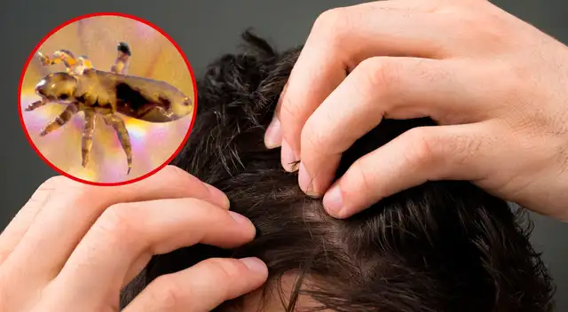 Significado de soñar con piojos