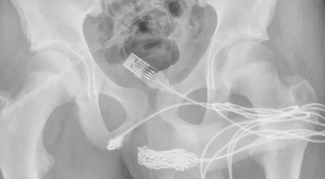 El menor realizó la práctica por “curiosidad sexual”. El menor realizó la práctica por “curiosidad sexual”.