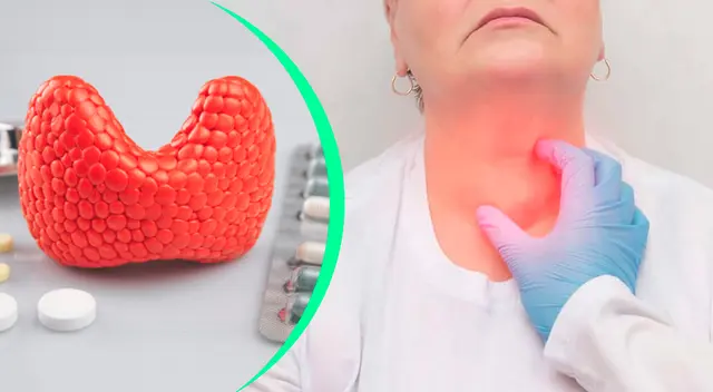 El cáncer de tiroides se produce cuando las células de la glándula tiroidea comienzan a crecer sin control.