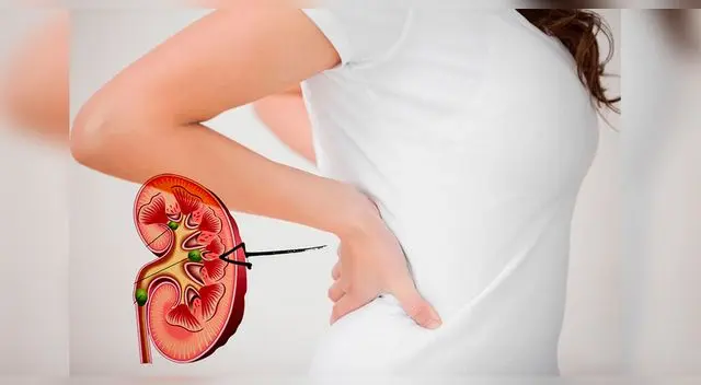 Otros factores que pueden ocasionar problemas renales son de origen genético. Foto: Andina/Referencial