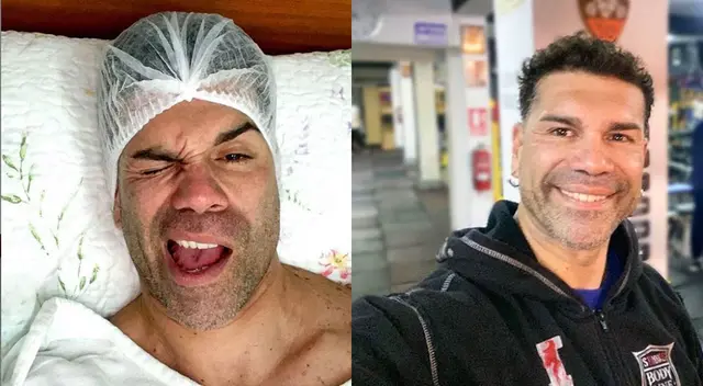 Tomate Barraza revela que se quitó glandulas mamarias. Tomate Barraza revela que se quitó glandulas mamarias.