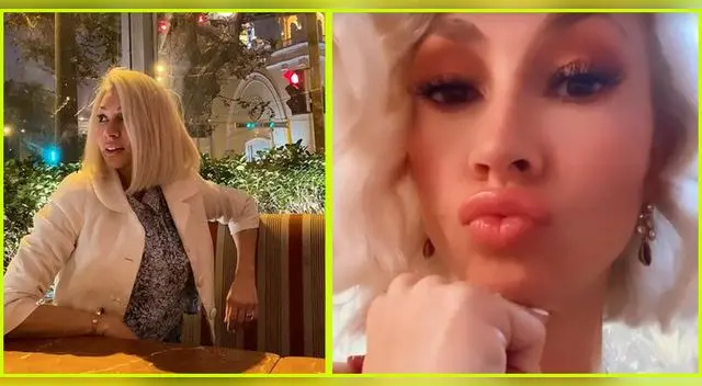 Belén Estévez se somete a 'Botox' facial.