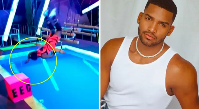 Alejandro Pino tuvo que recibir injerto de piel tras accidente.