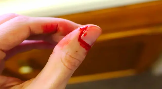 Significado de soñar con sangre de otra persona Significado de soñar con sangre de otra persona