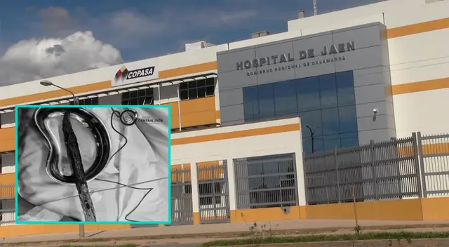 Retiran rama alojada en el cuello de un hombre que cayó a un matorral en Jaén. Retiran rama alojada en el cuello de un hombre que cayó a un matorral en Jaén.