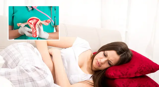 Los ovarios poliquísticos pueden causar infertilidad en el 70 % de mujeres. Los ovarios poliquísticos pueden causar infertilidad en el 70 % de mujeres.