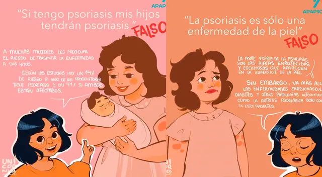 El 29 de octubre se celebra el Día Mundial de la Psoriasis, una enfermedad inflamatoria crónica de la piel.