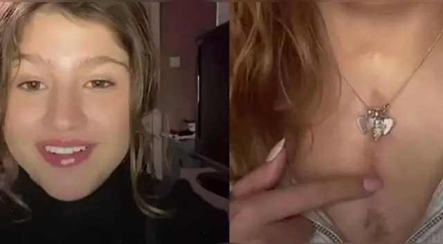 Sorprendente. La joven reveló a través de su cuenta de TikTok cómo se ve le operación hoy en día.