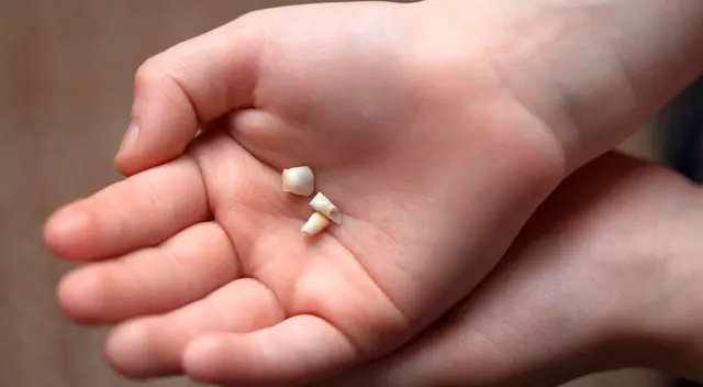 Significado de soñar con dientes caídos. Significado de soñar con dientes caídos.