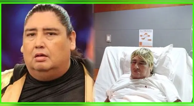 Tongo se encuentra de emergencia en UCI por derrame pulmonar.