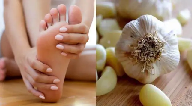 Algunos síntomas de los hongos son enrojecimiento y descamación de la piel. Algunos síntomas de los hongos son enrojecimiento y descamación de la piel.