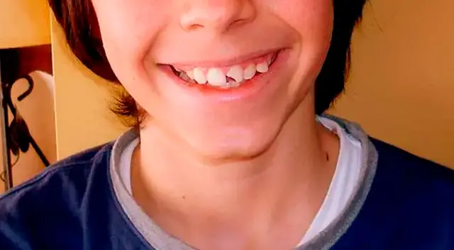 Significado de soñar que se me caen los dientes en pedacitos. Significado de soñar que se me caen los dientes en pedacitos.