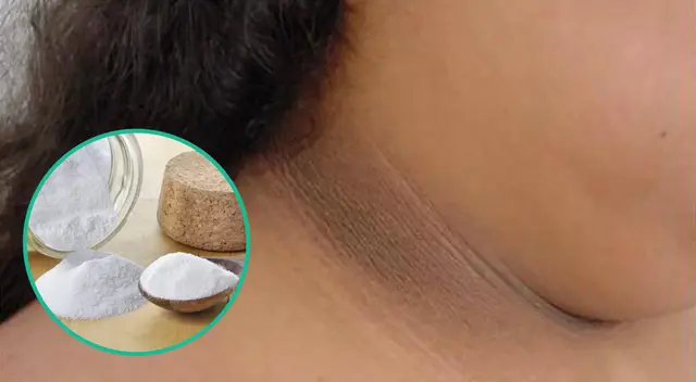 Las manchas en el cuello pueden aparecer por la exposición al sol, contacto con metales o enfermedades como la diabetes. Las manchas en el cuello pueden aparecer por la exposición al sol, contacto con metales o enfermedades como la diabetes.